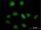 6-Phosphofructo-2-Kinase/Fructose-2,6-Biphosphatase 1 antibody, H00005209-B01P, Novus Biologicals, Immunofluorescence image 