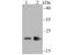 Chromobox 3 antibody, A01142-2, Boster Biological Technology, Western Blot image 