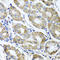 Electron Transfer Flavoprotein Subunit Alpha antibody, A05572, Boster Biological Technology, Immunohistochemistry paraffin image 
