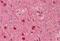 Doublecortin antibody, MBS249073, MyBioSource, Immunohistochemistry frozen image 