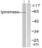 Tyrosinase antibody, abx013242, Abbexa, Western Blot image 