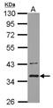 BRCA1/BRCA2-Containing Complex Subunit 3 antibody, NBP2-15609, Novus Biologicals, Western Blot image 