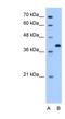 Torsin Family 2 Member A antibody, NBP1-60002, Novus Biologicals, Western Blot image 