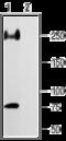 Sodium Voltage-Gated Channel Alpha Subunit 5 antibody, GTX54798, GeneTex, Western Blot image 