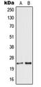 Secretogranin V antibody, orb214572, Biorbyt, Western Blot image 