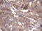 TARBP2 antibody, M01680-1, Boster Biological Technology, Immunohistochemistry paraffin image 