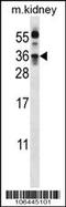 Kallikrein Related Peptidase 8 antibody, 62-250, ProSci, Western Blot image 