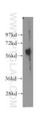 Endothelial Cell Adhesion Molecule antibody, 12445-1-AP, Proteintech Group, Western Blot image 