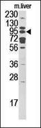 Mannosyl-oligosaccharide glucosidase antibody, 61-369, ProSci, Western Blot image 