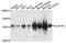 Aldehyde Dehydrogenase 7 Family Member A1 antibody, A8629, ABclonal Technology, Western Blot image 