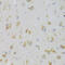 KISS1 Receptor antibody, 18-887, ProSci, Immunohistochemistry paraffin image 