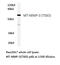 Matrix Metallopeptidase 16 antibody, LS-C176125, Lifespan Biosciences, Western Blot image 