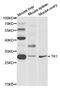 Thymidine Kinase 1 antibody, MBS2517097, MyBioSource, Western Blot image 