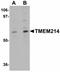 Transmembrane Protein 214 antibody, LS-C108568, Lifespan Biosciences, Western Blot image 