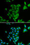 RD antibody, STJ28226, St John