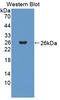 Suppressor Of Cytokine Signaling 2 antibody, LS-C374906, Lifespan Biosciences, Western Blot image 