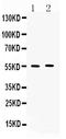 Matrix Metallopeptidase 11 antibody, A04490-1, Boster Biological Technology, Western Blot image 