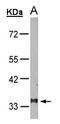 Leukotriene B4 Receptor antibody, PA5-34622, Invitrogen Antibodies, Western Blot image 