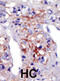 Phosphatidylinositol-4-Phosphate 5-Kinase Type 1 Gamma antibody, abx033837, Abbexa, Immunohistochemistry paraffin image 