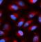 Acid Phosphatase 5, Tartrate Resistant antibody, FNab00100, FineTest, Immunofluorescence image 
