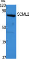 Scm Polycomb Group Protein Like 2 antibody, GTX34191, GeneTex, Western Blot image 