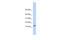 CMT1A Duplicated Region Transcript 4 antibody, 31-312, ProSci, Enzyme Linked Immunosorbent Assay image 