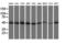 Ribonuclease/Angiogenin Inhibitor 1 antibody, GTX83696, GeneTex, Western Blot image 