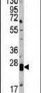 Claudin 1 antibody, PA5-13333, Invitrogen Antibodies, Western Blot image 