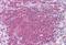 Checkpoint Kinase 2 antibody, NB100-56546, Novus Biologicals, Immunohistochemistry paraffin image 