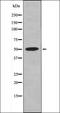 Retinoic Acid Receptor Alpha antibody, orb335873, Biorbyt, Western Blot image 