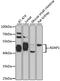 ArfGAP With Dual PH Domains 1 antibody, A07298, Boster Biological Technology, Western Blot image 