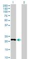 Phosphodiesterase 4D Interacting Protein antibody, H00009659-D01P, Novus Biologicals, Western Blot image 