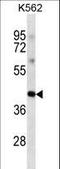 POU Class 5 Homeobox 1 antibody, LS-C203695, Lifespan Biosciences, Western Blot image 