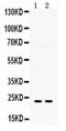 Insulin Like Growth Factor Binding Protein 5 antibody, PA5-79454, Invitrogen Antibodies, Western Blot image 