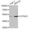 Cytochrome P450 Family 4 Subfamily V Member 2 antibody, A6573, ABclonal Technology, Western Blot image 