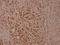 Inhibitor Of Nuclear Factor Kappa B Kinase Subunit Beta antibody, A00118Y199, Boster Biological Technology, Immunohistochemistry frozen image 