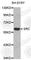 SRC Proto-Oncogene, Non-Receptor Tyrosine Kinase antibody, A0323, ABclonal Technology, Western Blot image 