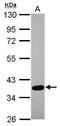 SPARC (Osteonectin), Cwcv And Kazal Like Domains Proteoglycan 3 antibody, GTX119149, GeneTex, Western Blot image 