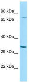 RAS Like Family 11 Member A antibody, TA333312, Origene, Western Blot image 