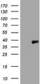 Phosphatidylinositol-4-phosphate 3-kinase C2 domain-containing subunit alpha antibody, CF801651, Origene, Western Blot image 