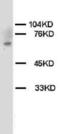 Checkpoint Kinase 2 antibody, orb18109, Biorbyt, Western Blot image 