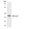 Olfactory Receptor Family 52 Subfamily A Member 5 antibody, LS-C200383, Lifespan Biosciences, Western Blot image 