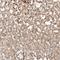 Cyclin D2 antibody, NBP2-14460, Novus Biologicals, Immunohistochemistry paraffin image 