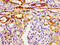 Growth Hormone Secretagogue Receptor antibody, LS-C670262, Lifespan Biosciences, Immunohistochemistry paraffin image 
