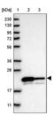 Gamma-glutamylcyclotransferase antibody, PA5-54263, Invitrogen Antibodies, Western Blot image 