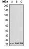 Activating Transcription Factor 3 antibody, orb216025, Biorbyt, Western Blot image 