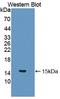 Interleukin 5 antibody, LS-C372449, Lifespan Biosciences, Western Blot image 