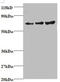 TIMP Metallopeptidase Inhibitor 2 antibody, A51769-100, Epigentek, Western Blot image 