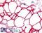 CD36 Molecule antibody, LS-C142200, Lifespan Biosciences, Immunohistochemistry paraffin image 