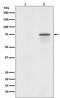 Raf-1 Proto-Oncogene, Serine/Threonine Kinase antibody, P00446-5, Boster Biological Technology, Western Blot image 